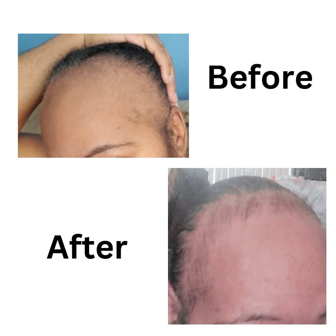 KaJeZi - Hair & Scalp Treatment Oil